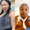 Nollywood actress, Tope Osoba, has undergone her breast cancer surgery.